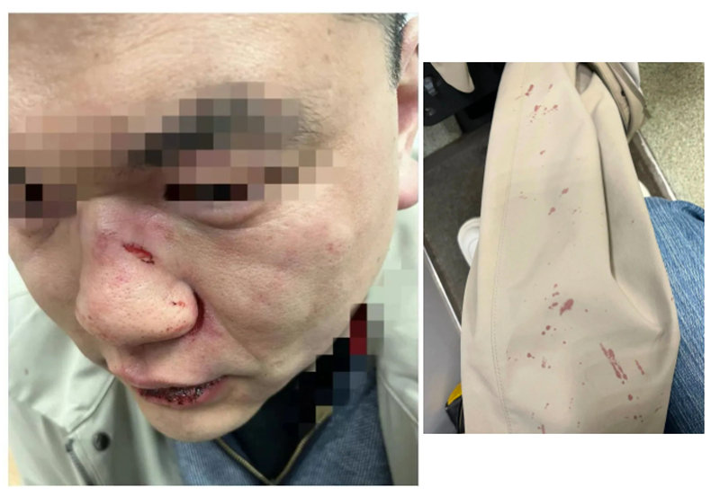 中国留学生伦敦地铁遭黑人重拳袭击: 